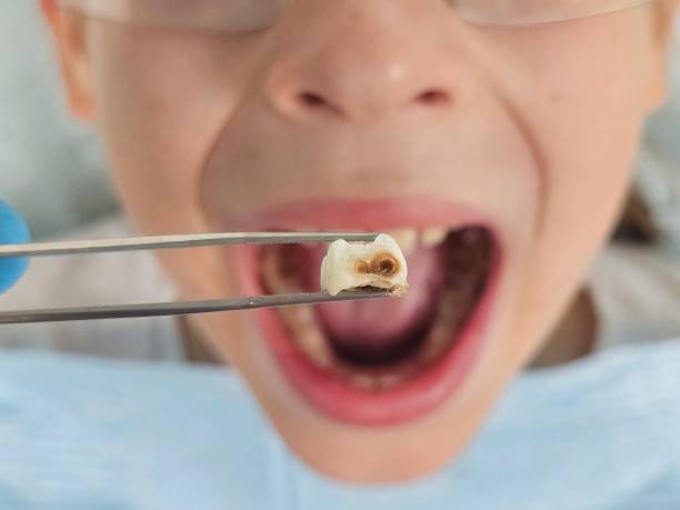 Best Emergency TMJ Treatment in Scottsburg, IN