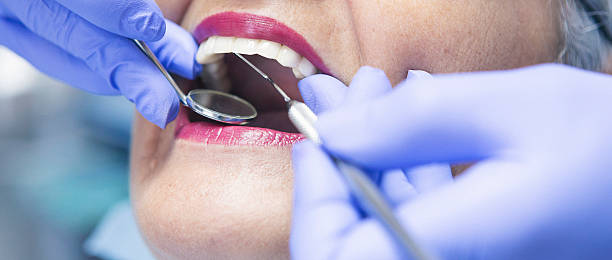 Best Emergency Tooth Extraction in Scottsburg, IN